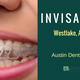 Illustration for article titled Invisalign Dental Treatment in Austin, TX: The Ultimate Alternative to Braces!em/em